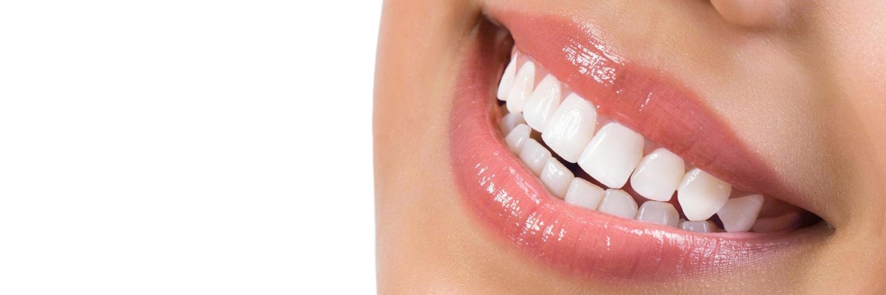 Dental Implants | Dentist
